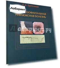 Гастроэзофагеальная рефлюксная болезнь