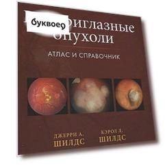 Внутриглазные опухоли. Атлас и справочник