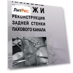 Паховые грыжи. Реконструкция задней стенки пахового канала.