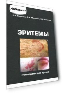Эритемы. Руководство для врачей
