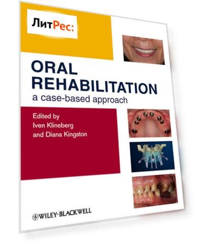 Oral Rehabilitation. A Case-Based Approach
