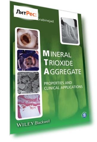 Mineral Trioxide Aggregate