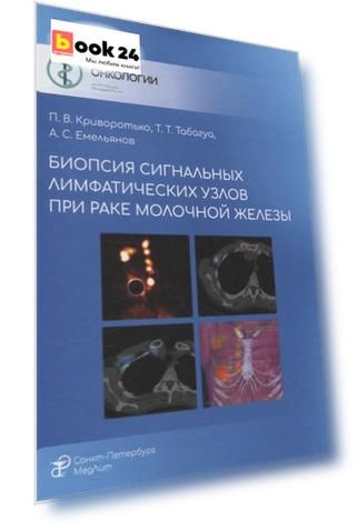 Биопсия сигнальных лимфатических узлов при раке молочной железы