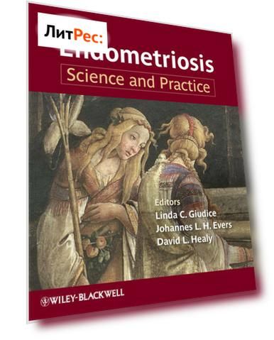 Endometriosis